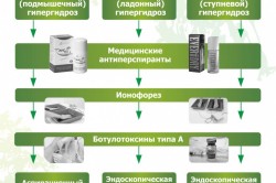 Способы лечения гипергидроза Способы лечения гипергидроза