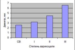 График степеней варикоцеле График степеней варикоцеле