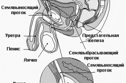 Стерилизация Стерилизация