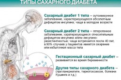 Типы сахарного диабета