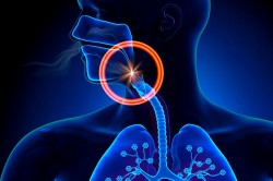 Тонизирование мышц гортани Тонизирование мышц гортани