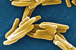 Возбудитель туберкулеза простаты Tuberculosis-of-prostate