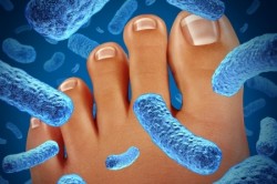 Уничтожение микробов Уничтожение микробов