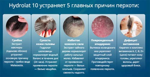 Устранение перхоти Устранение перхоти