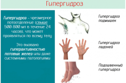 Виды гипергидроза Виды гипергидроза