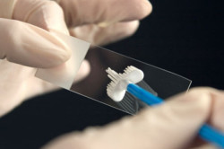 Мазок Мазок