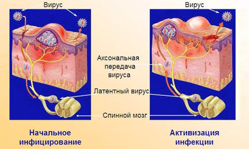 Вирус генитального герпеса Вирус генитального герпеса