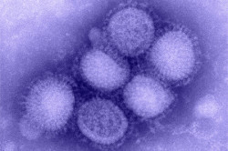 Вирус свинки Вирус свинки