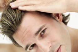 Выпадение волос Выпадение волос