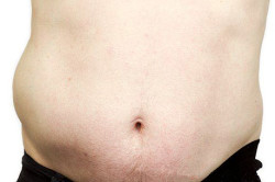 Выпячивание паховой грыжи Выпячивание паховой грыжи