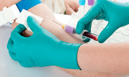 Взятие крови Взятие крови