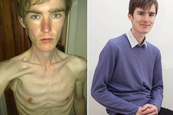 Худоба у мужчин