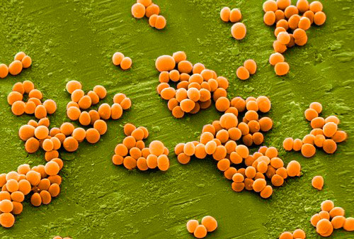 Золотистый стафилококк Золотистый стафилококк