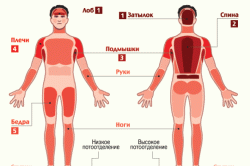Зоны потоотделения Зоны потоотделения