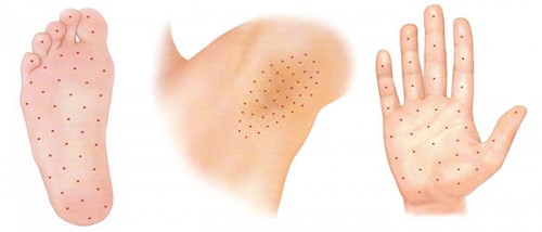 Зоны введения Зоны введения