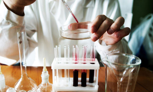 Анализ крови на простат-специфический антиген Анализ крови на простат-специфический антиген