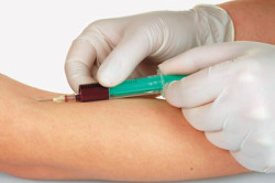 Анализ венозной крови