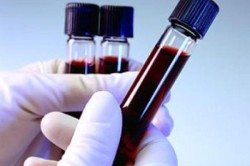 Исследование ПСА Исследование ПСА