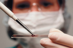 Анализ крови Анализ крови