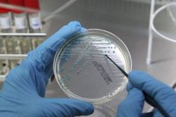 Взятие мазка Взятие мазка