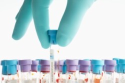 Анализы Анализы