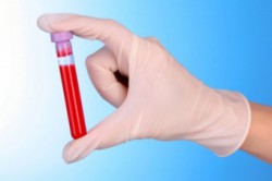 Забор крови на анализ