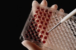 Проведение анализа на АЛТ Проведение анализа на АЛТ