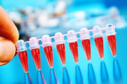 Анализы на половые инфекции Анализы на половые инфекции