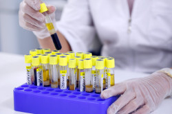 Лабораторные исследования