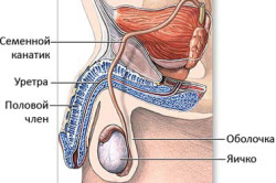 Орхит Орхит