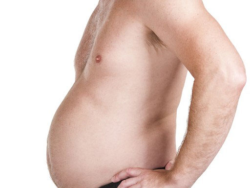 Асцит Асцит