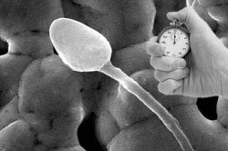 Плохая подвижность спермы Плохая подвижность спермы