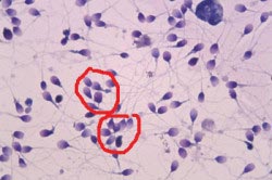 Склеивание спермиев