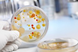 Колонии микроорганизмов при бак посеве Колонии микроорганизмов при бак посеве
