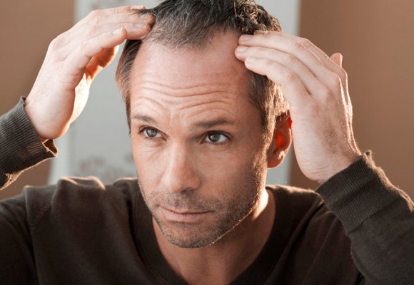 Выпадение волос Выпадение волос