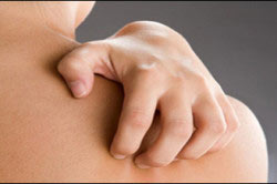 Сыпь на теле из-за чесотки Сыпь на теле из-за чесотки