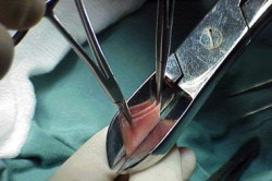 Процедура обрезания Процедура обрезания