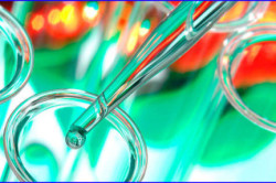 Анализы на уреаплазму Анализы на уреаплазму