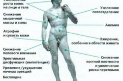 Последствия дефицита тестостерона Последствия дефицита тестостерона