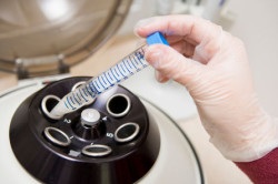 Диагностика хламидиоза Диагностика хламидиоза