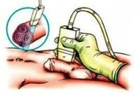 Проведение процедуры допплерографии Проведение процедуры допплерографии