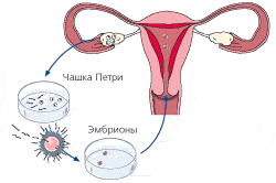 Процедура ЭКО Процедура ЭКО