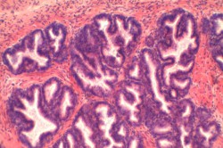 Мышечно-эластичные элементы простаты под микроскопом Мышечно-эластичные элементы простаты под микроскопом