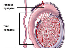 Эпидидимит - воспаление придатков