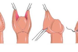Процесс обрезания Процесс обрезания
