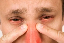 Гайморит Гайморит