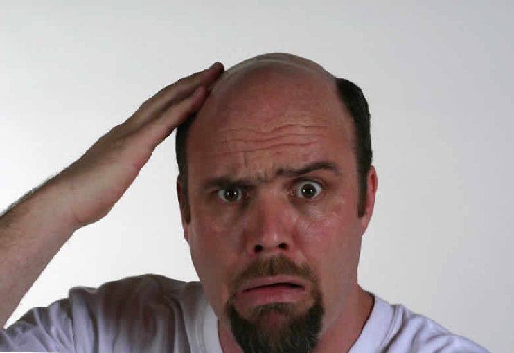 Частичное облысение у мужчины Частичное облысение у мужчины