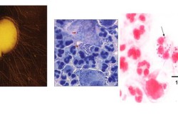 Гонококки в электронном микроскопе и в гное Гонококки в электронном микроскопе и в гное