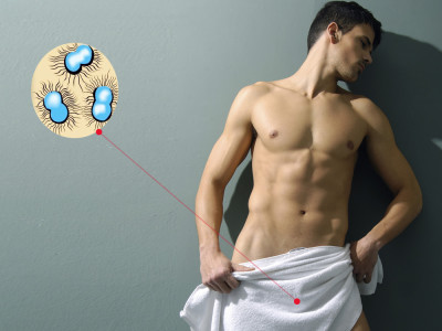 Гонорейный уретрит Гонорейный уретрит