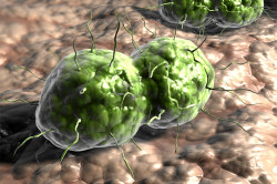 Гонококки Гонококки